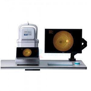 [Hot Item] Ophthmic Automatic Focus and Exposure Dicom and Ai System Eye Fundus Camera