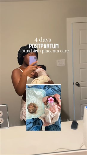 AraeyaNia on Instagram: "How I change out and care for my newborns placenta 🩷"