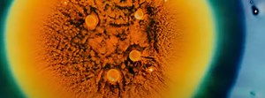 Using AI for Early Detection of Pancreatic Cancer