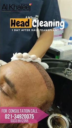 Best Hair Transplant Clinic in Karachi | Combined PRP & ICE FUE Results