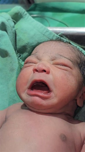 330K views · 10K reactions | First pregnancy with Normal delivery with single loop of cord around neck樂 #baby #oralsection #cutebaby #viralvideochallenge #babycare #abdominaldistention | Gautam Ashish | Facebook