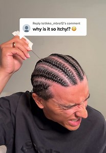 Gunther hair growth after taking braids out — how I stopped itchy scalp