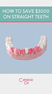 “I’ve wanted to improve my smile for a long time. When I heard about Candid I was skeptical that someone could make the process easier and significantly less expensive, but they have!” - Susan H. ★★★★★ Learn more >>> https://get.candidco.com/lp | Candid
