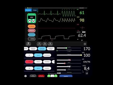 Simpl patient monitor APP demonstration (How to use simple monitor app)