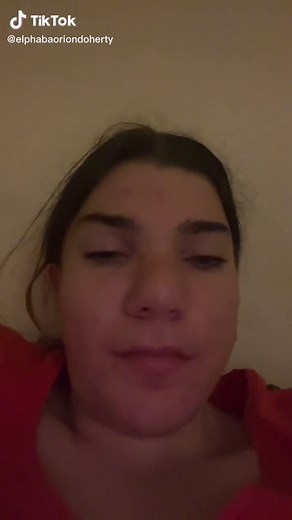 Confronting Phobia of Moths with Elphaba Orion Doherty