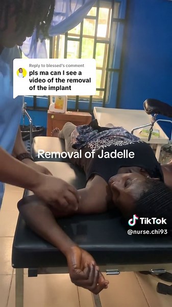 Jadelle Birth Control Implant Removal: What to Expect