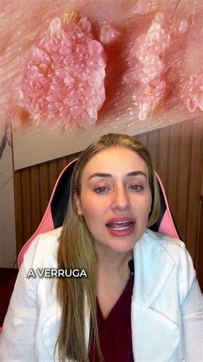 Virgin with HPV, is that possible?