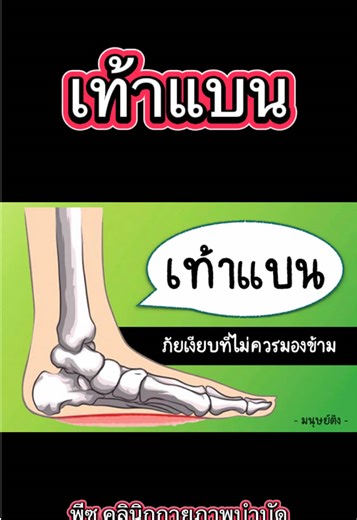 ภาวะเท้าแบน ภัยเงียบที่ไม่ควรมองข้าม #เท้าแบน #เท้าล้ม #พีซคลินิกกายภาพบําบัด #กายภาพบำบัด #คลินิกกายภาพบำบัด