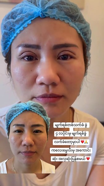 Myanmar Women in Malaysia: Experiences and Resilience