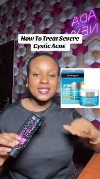 How to treat severe acne