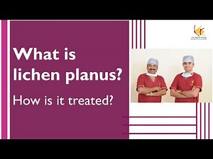 What is lichen planus? How is it treated?