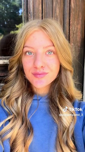 Skin Microneedling Progress: First, Second, Third Session Results