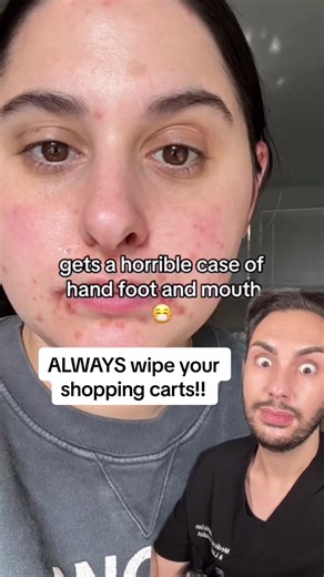 Hand foot mouth disease 🤝 shopping carts Surfaces are covered in bacteria and viruses. Something you can do to eliminate that is wiping things down with a disinfectant wipe. If you do use a wipe, keep in mind that there’s a contact time (written on product) which indicates how long the surface needs to be wet before it actually kills the 99.99% of bacteria. #storytime #disinfectant #disinfect #healthandsafety #dermatology