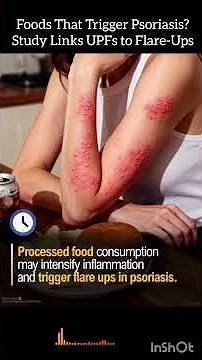 Ultra-Processed Foods Linked to Psoriasis Flare-Ups, Study Suggests