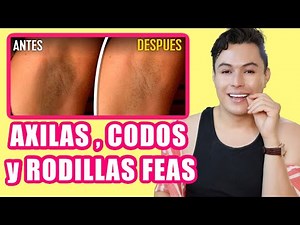 Lighten Your Underarm, Elbow, and Knee Blemishes with Creams and Home Remedies | Yasmany