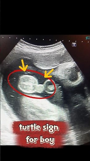 turtle sign for #babyboy