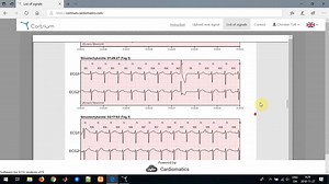 Cortrium - Installation des Data Transfer Tool (DTT) und Gebrauch von Cardiomatics