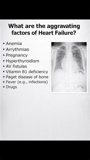 Aggravating factors of heart. failure.#cardiology #usmle #mccqe