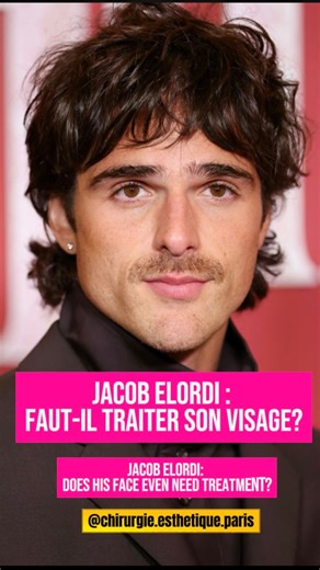 Dr Philippe LEVAN | Chirurgie & Médecine Esthétique on Instagram: "🇫🇷Préambule : Cette analyse est purement pédagogique et anatomique. Elle n’incite en aucun cas à recourir à un traitement esthétique lorsqu’il n’y a pas de besoin ressenti. Jacob Elordi a 28 ans, un âge charnière où la maturation faciale est terminée et où commencent les premiers mécanismes du vieillissement. Son visage présente déjà une structure masculine équilibrée : les volumes du tiers moyen se sont affinés, les pommettes