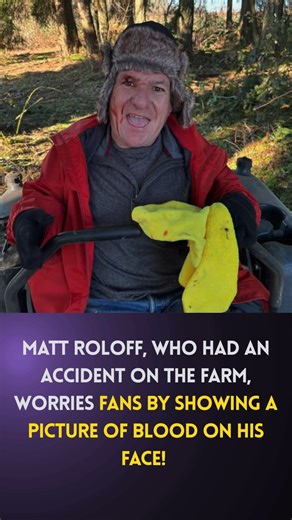 11K views · 42 reactions | Matt Roloff, who had an accident on the farm, worries fans by showing a picture of blood on his face!  https://www.tvseasonspoilers.com/news/lpbw-matt-shares-new-hobby-after-his-caryns-retirement/ | 7 Little Johnstons News And Updates | Facebook