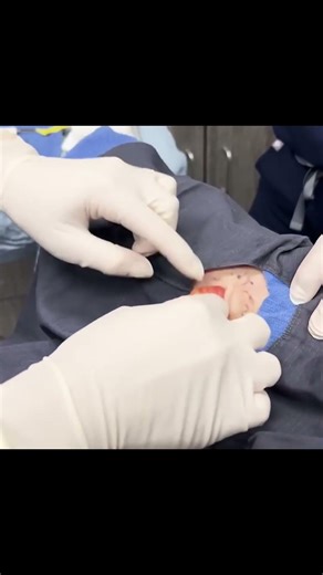 What Came Out of Her Arm!