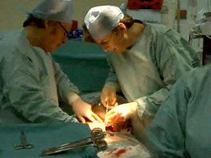 What is involved in a caesarean section? (Video)