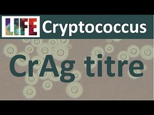 Interpreting CrAg titres