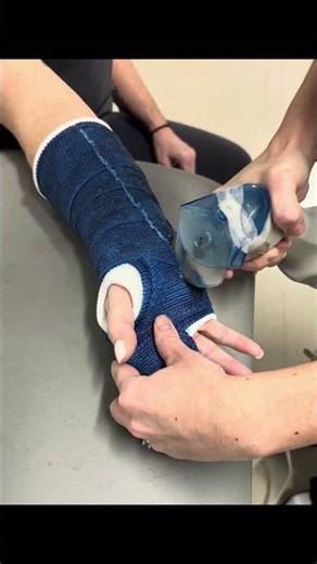 Cast removal Radial Gutter