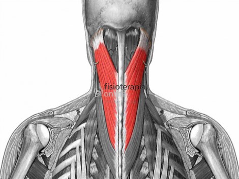 Músculo esplenio del cuello y de la cabeza