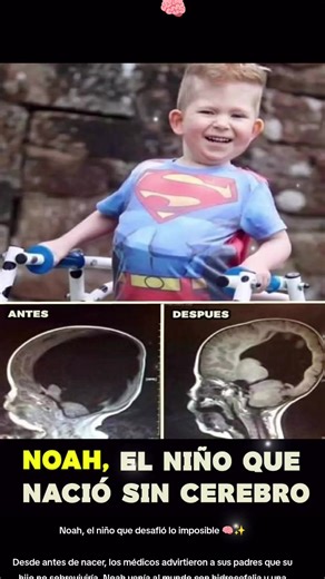 Noah, el niño que desafió lo imposible y venció