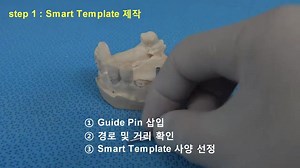 10K views · 40 reactions | Buscas cirugía guiada para un caso clinico sencillo? Nosotros te damos una solucion rápida con alta precision sin necesidad de tomografia | Miguelito coreano | Facebook