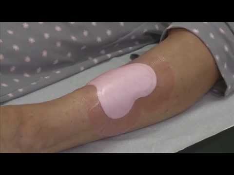 ALLEVYN Gentle Border Multisite application to the leg