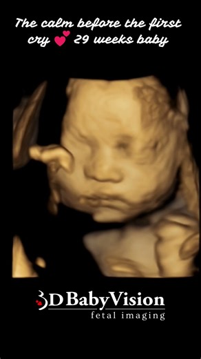 Dreaming peacefully, waiting to meet the world. - 3D BabyVision Hamilton
