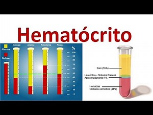 HEMATÓCRITO - Gabrielly Santos. Realizando a coleta de sangue para o Teste do Hematócrito