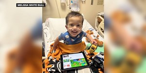 Three-year-old boy to undergo open heart surgery for rare heart defect