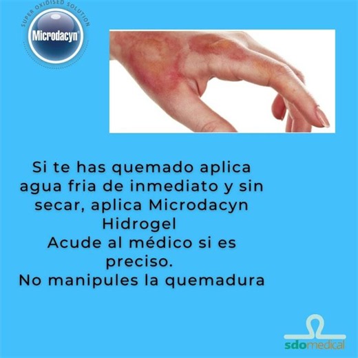 ¿SABÍAS QUE? si te has quemado, aplica agua fría de inmediato y sin secar, aplica Microdacyn gel
