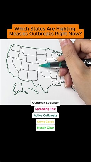 POV: a disease from the history books is spreading in your state again 😭😷 #measles #health #statesoftiktok #usmap #relatable #viral #tiktokusa