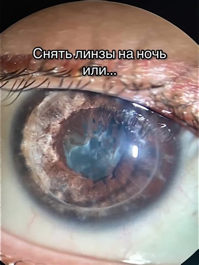 Close-Up of a Brown Iris: Discover Human Eye Details