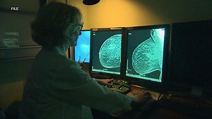 New study on mammogram technology compares likelihood of false positives