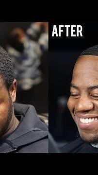 HOW TO FIX A RECEDING HAIRLINE