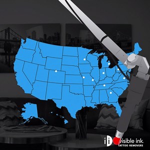 10K views · 15 reactions | World's largest tattoo removal chain? ✓ Best technology in the biz? ✓ And we're just getting started.  bit.ly/InvisInkLocations | Removery | Facebook