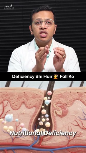 Hair Fall Reason | Why Is Your Hair Falling Out? 6 Root Causes of Hair Loss You Should Know