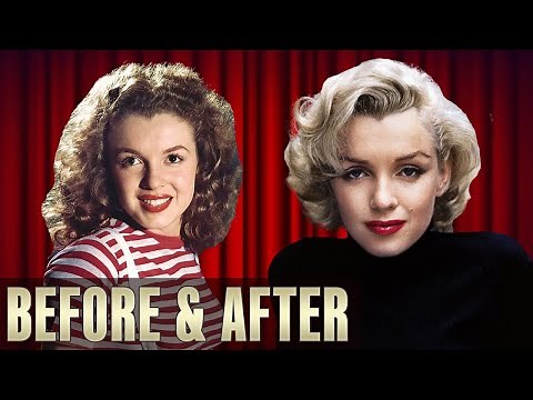 Marilyn Monroe: Plastic Surgery