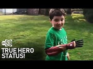 8-year-old boy gets Marvel-themed bionic arm