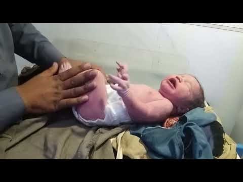 How to Do a Newborn Baby Assessment | Step-by-Step Guide for Nurses