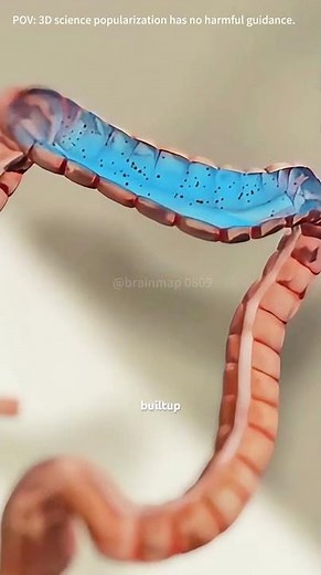 How Is Colon Hydrotherapy Performed( (3D Animation)#colonhydrotherapy #intestinalirrigation