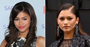 Did Zendaya Ever Get Plastic Surgery? Rumors Explained, Photos