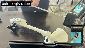 Lantern Hip - sawbones workflow - lateral | OrthAlign, Inc.