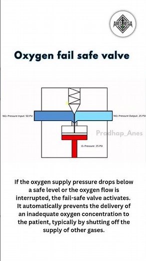 Oxygen fail safe valve #anesthesia