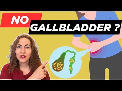 NO GALLBLADDER? Here's What You NEED to Know!